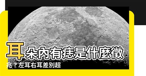 右耳朵突然長痣